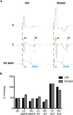 Severe Bradycardia Increases the Incidence and Severity of Torsade de Pointes Arrhythmias by Augmenting Preexistent Spatial Dispersion of Repolarization in the CAVB Dog Model